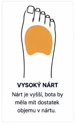 Vysoký nárt u dítěte